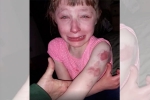 Wisconsin girl, school bus, 10 year old special needs child brutally bitten on arm while returning home in school bus, Special needs