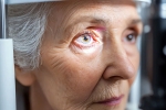 Glaucoma breaking, Glaucoma health experts, all about the eye disease glaucoma, Doctor