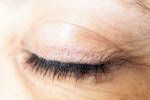 Eyelash Dandruff medication, Eyelash Dandruff news, all about eyelash dandruff, Contact lens