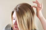 Itchy scalp, Remedies, remedies to get rid of itchy scalp, Itchy scalp