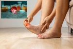 Gout Drugs updates, Gout Drugs on heart attack, gout drugs may cut the risk of heart attack, Episode