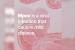 mpox cases, mpox symptoms, mpox emergency again, Neighbouring countries