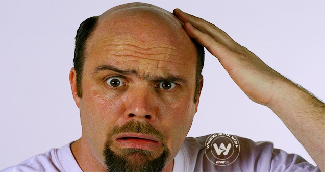 What&#039;s your balding hair strategy?},{What&#039;s your balding hair strategy?