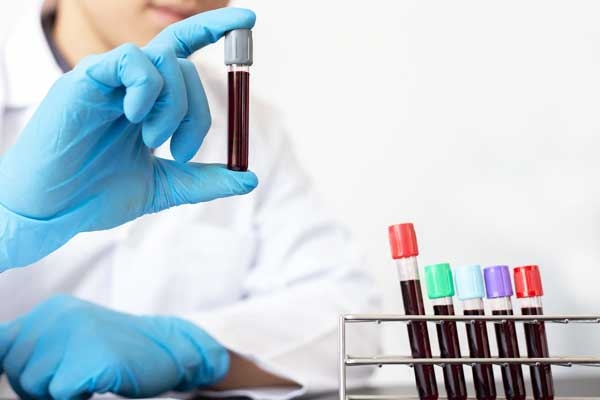A Simple Blood Test That Can Detect Cancer