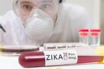 Zika Virus, Zika screening, fda expands zika screening to all us blood centers, West nile virus